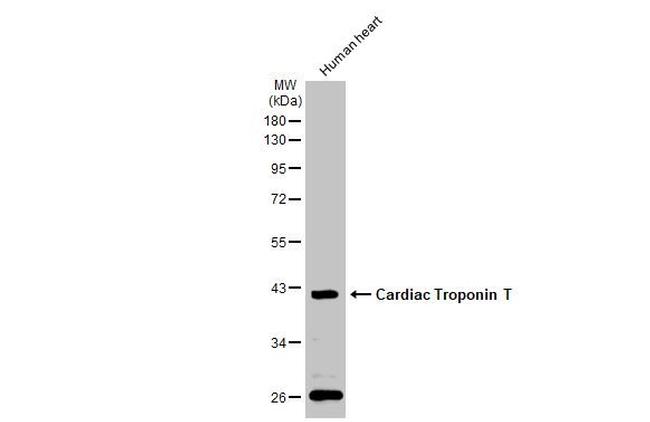 Cardiac Troponin T Antibody in Western Blot (WB)