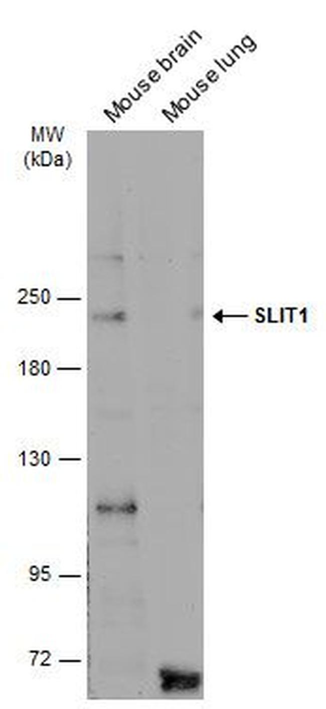 SLIT1 Antibody in Western Blot (WB)