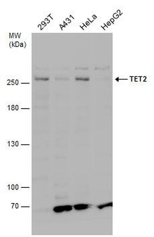TET2 Antibody in Western Blot (WB)