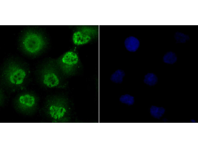 Fyn Antibody in Immunocytochemistry (ICC/IF)