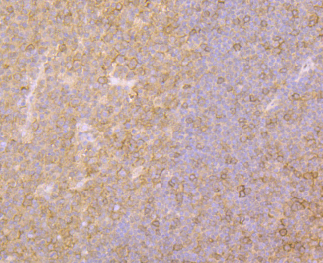 Fyn Antibody in Immunohistochemistry (Paraffin) (IHC (P))