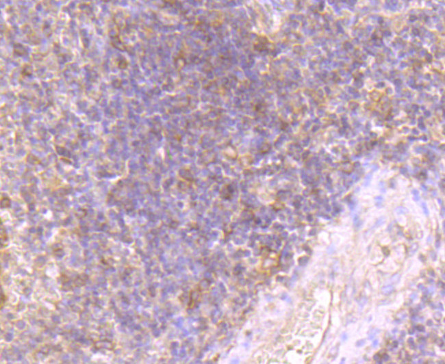 Fyn Antibody in Immunohistochemistry (Paraffin) (IHC (P))