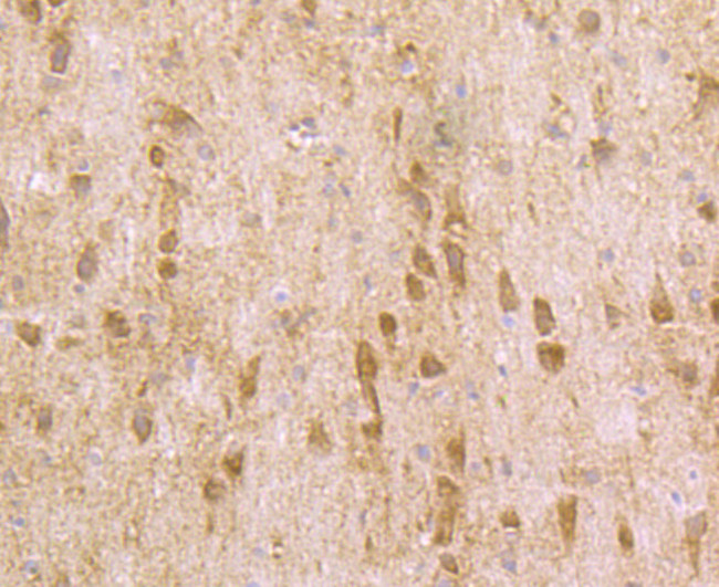 Fyn Antibody in Immunohistochemistry (Paraffin) (IHC (P))