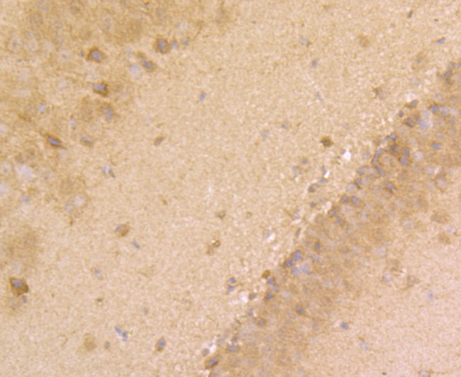 Fyn Antibody in Immunohistochemistry (Paraffin) (IHC (P))