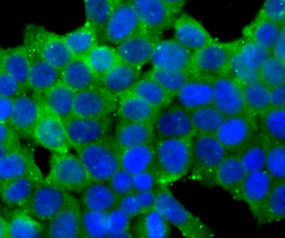 Carbonic anhydrase II Antibody in Immunocytochemistry (ICC/IF)