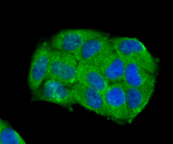 Carbonic anhydrase II Antibody in Immunocytochemistry (ICC/IF)