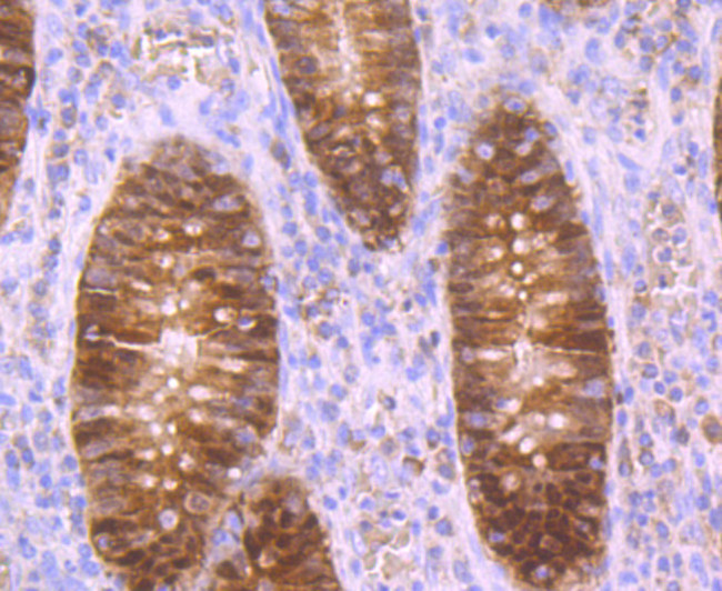 Carbonic anhydrase II Antibody in Immunohistochemistry (Paraffin) (IHC (P))