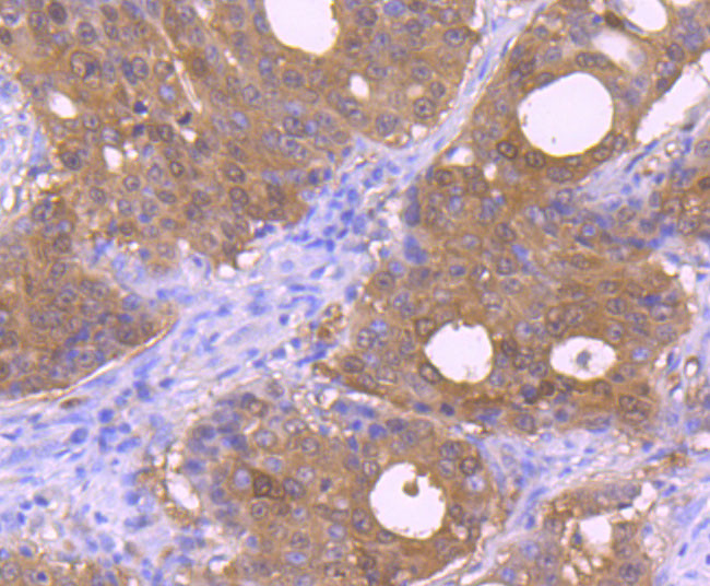 Carbonic anhydrase II Antibody in Immunohistochemistry (Paraffin) (IHC (P))