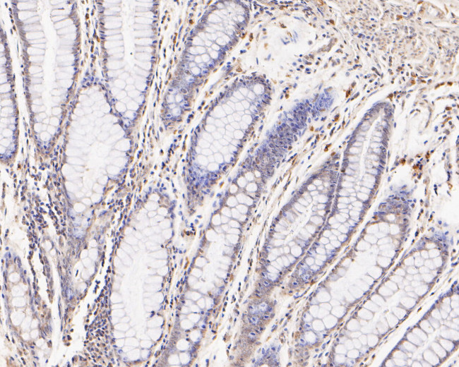 FYCO1 Antibody in Immunohistochemistry (Paraffin) (IHC (P))