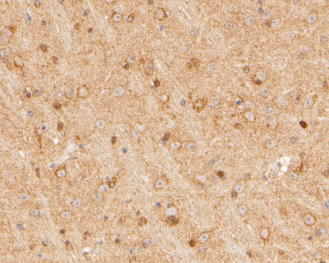 SYNDIG1 Antibody in Immunohistochemistry (Paraffin) (IHC (P))