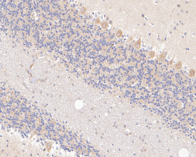 SYNDIG1 Antibody in Immunohistochemistry (Paraffin) (IHC (P))