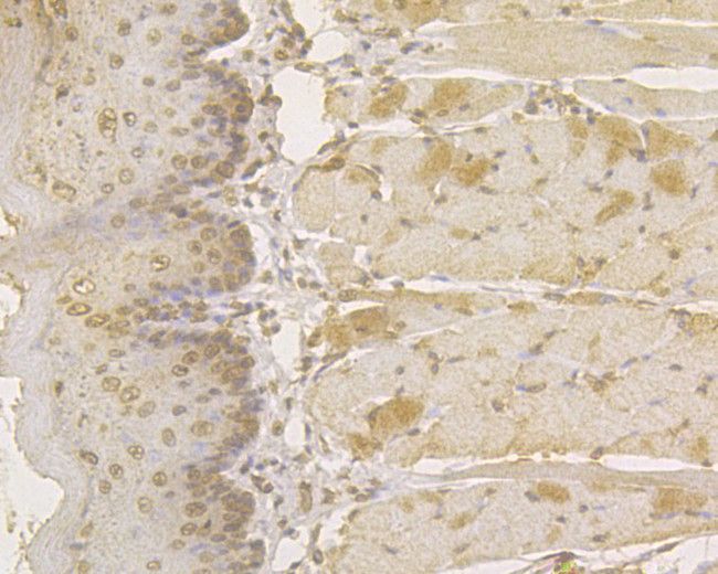 PKP3 Antibody in Immunohistochemistry (Paraffin) (IHC (P))