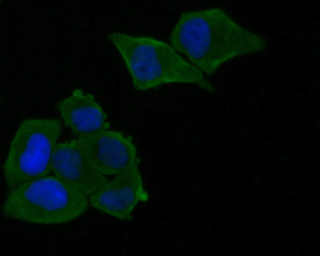 Munc13-4 Antibody in Immunocytochemistry (ICC/IF)