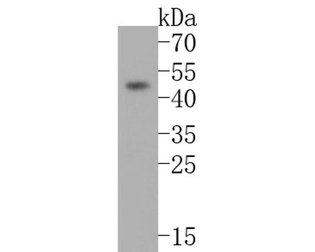 PHLDA1 Antibody in Western Blot (WB)