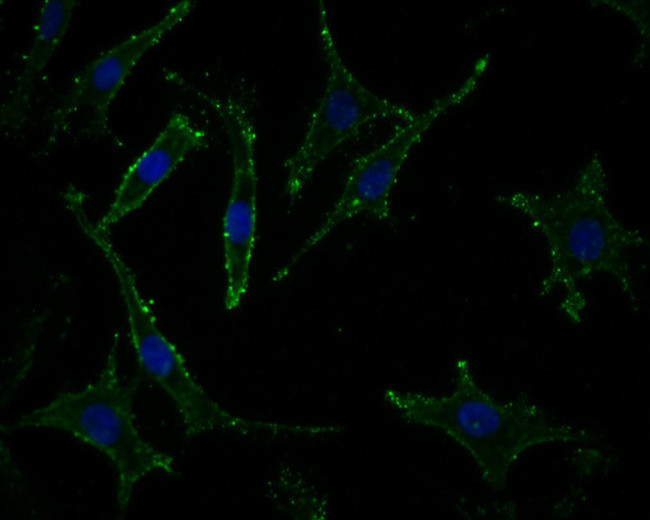 PPP1R9A Antibody in Immunocytochemistry (ICC/IF)