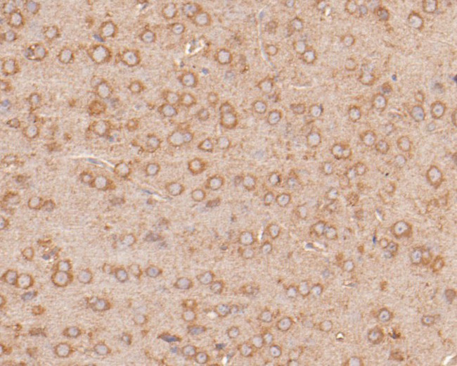 PPP1R9A Antibody in Immunohistochemistry (Paraffin) (IHC (P))