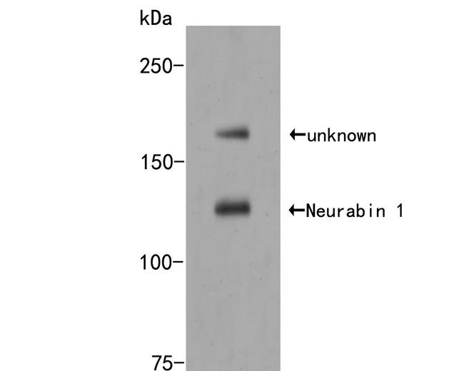 PPP1R9A Antibody in Western Blot (WB)