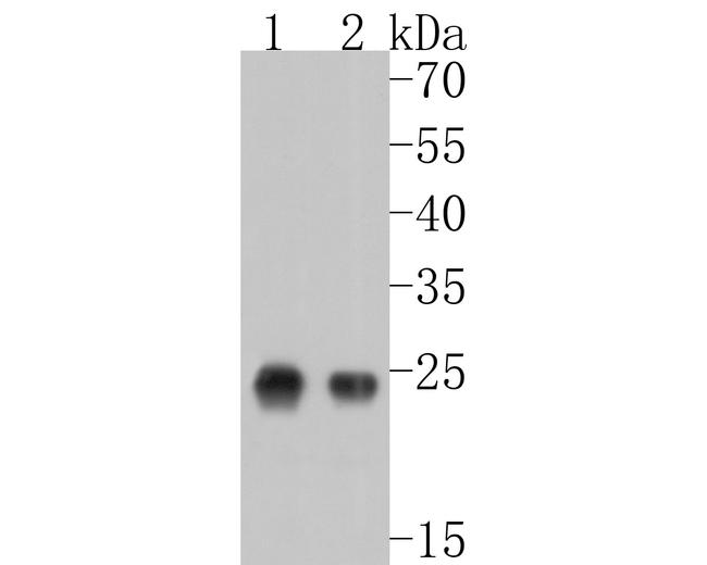 ZFHX3 Antibody in Western Blot (WB)