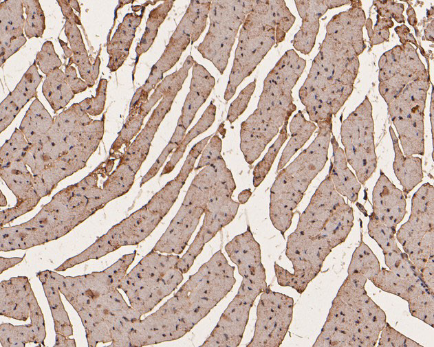 PFKFB2 Antibody in Immunohistochemistry (Paraffin) (IHC (P))