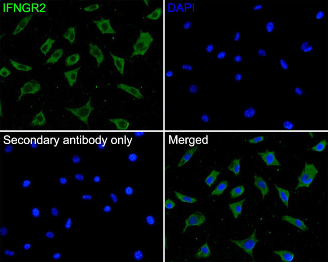 IFNGR2 Antibody in Immunocytochemistry (ICC/IF)