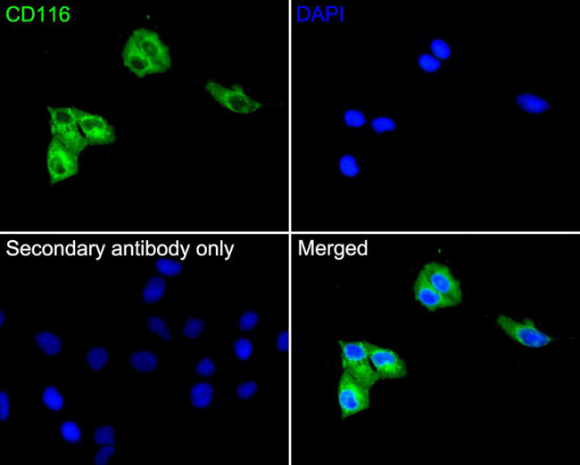 CD116 Antibody in Immunocytochemistry (ICC/IF)