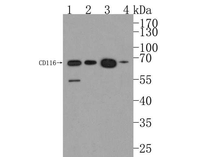CD116 Antibody in Western Blot (WB)