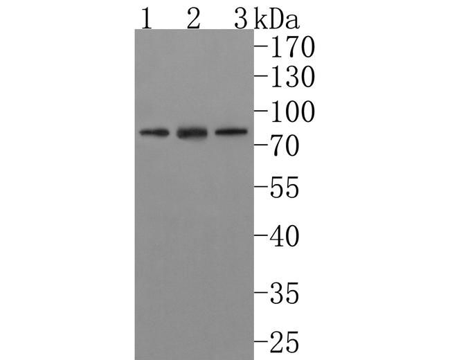 IL21R Antibody in Western Blot (WB)