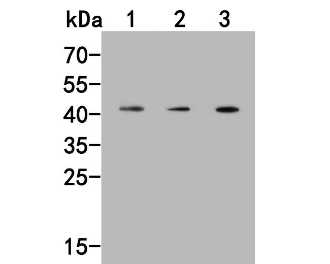 PRR5 Antibody in Western Blot (WB)