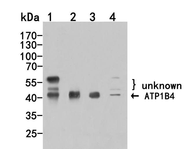 ATP1B4 Antibody in Western Blot (WB)