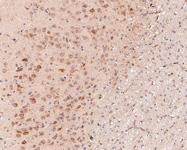 P-Glycoprotein Antibody in Immunohistochemistry (Paraffin) (IHC (P))