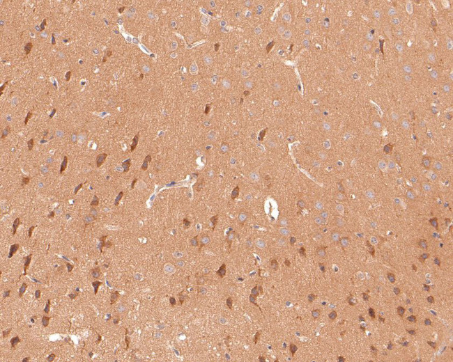 GNB5 Antibody in Immunohistochemistry (Paraffin) (IHC (P))