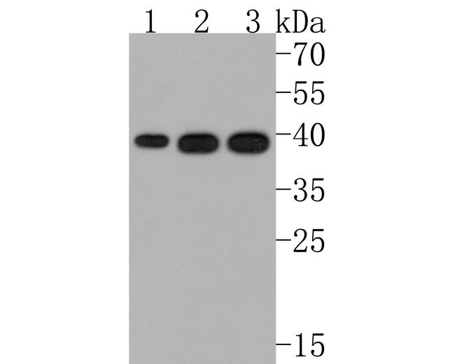 GNB5 Antibody in Western Blot (WB)