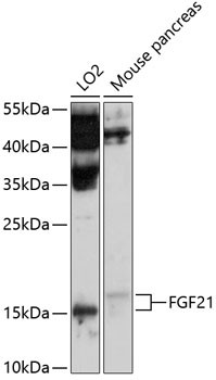 FGF21 Antibody in Western Blot (WB)