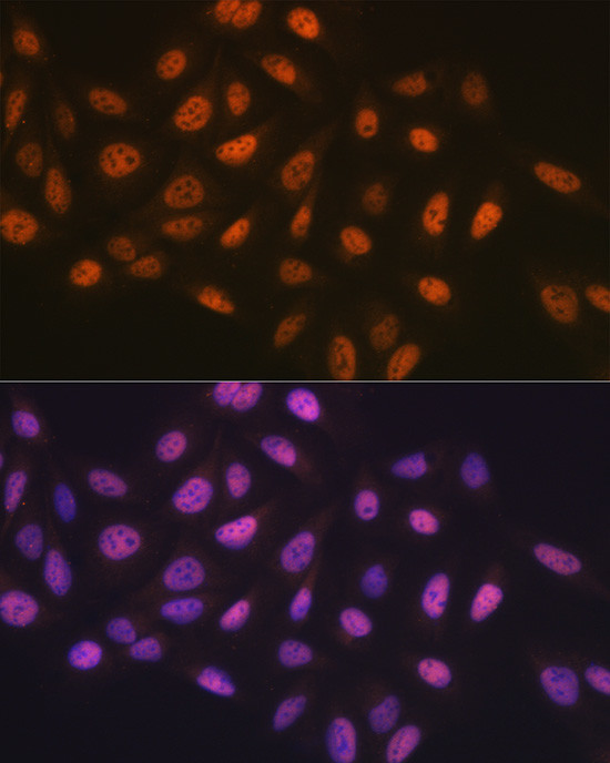 MCM7 Antibody in Immunocytochemistry (ICC/IF)