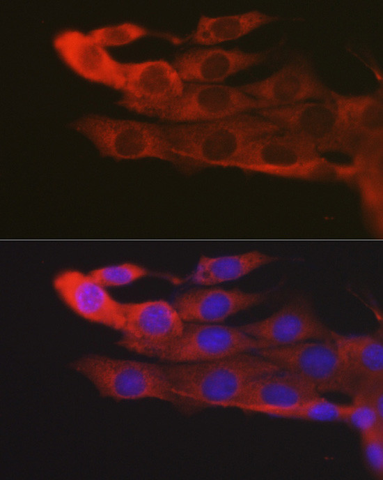 JAK2 Antibody in Immunocytochemistry (ICC/IF)