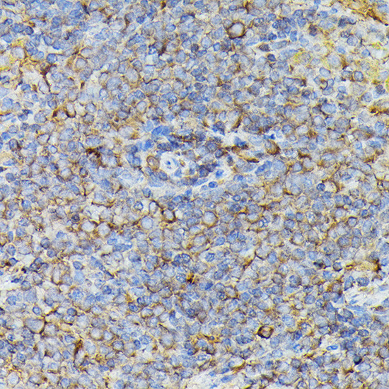 JAK2 Antibody in Immunohistochemistry (Paraffin) (IHC (P))