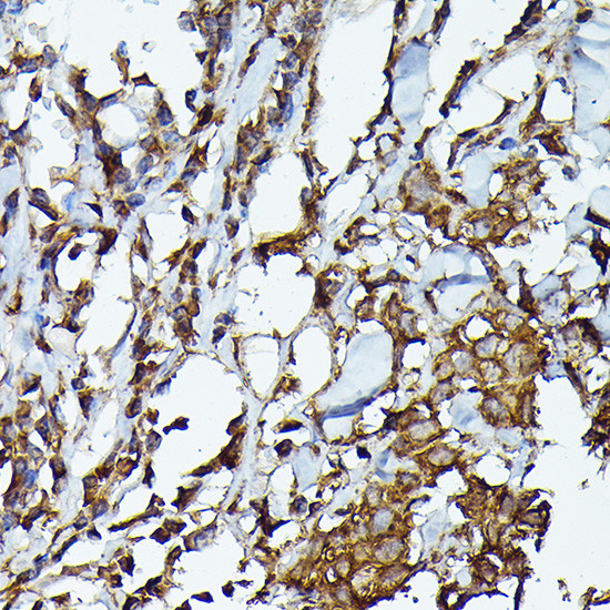 JAK2 Antibody in Immunohistochemistry (Paraffin) (IHC (P))