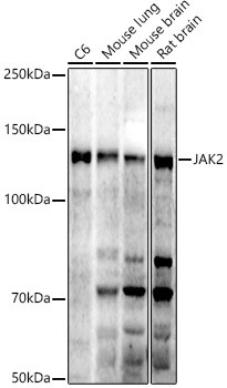 JAK2 Antibody in Western Blot (WB)