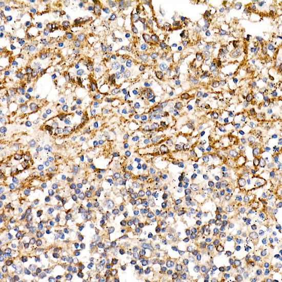 BST-2 Antibody in Immunohistochemistry (Paraffin) (IHC (P))