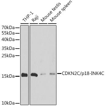 CDKN2C Antibody in Western Blot (WB)