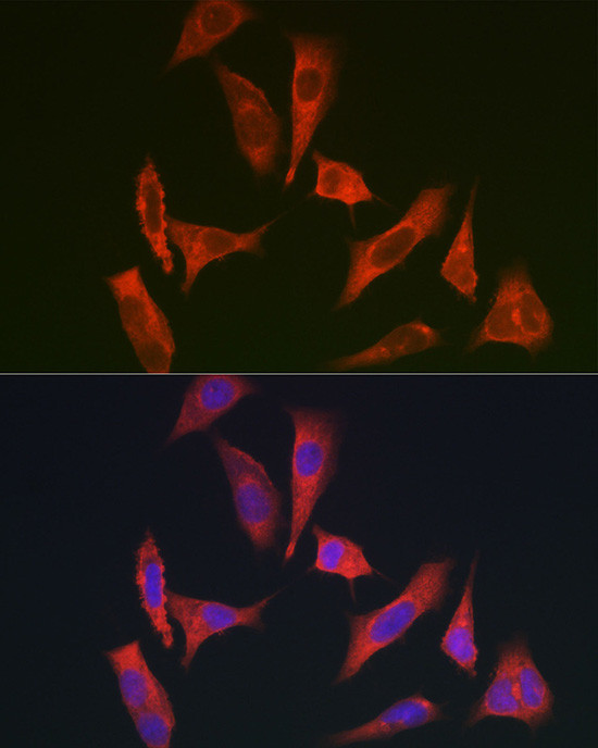 MYO10 Antibody in Immunocytochemistry (ICC/IF)