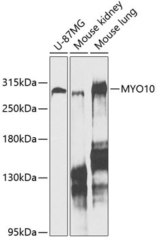 MYO10 Antibody in Western Blot (WB)