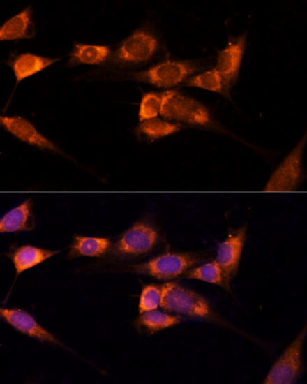 TXNDC12 Antibody in Immunocytochemistry (ICC/IF)