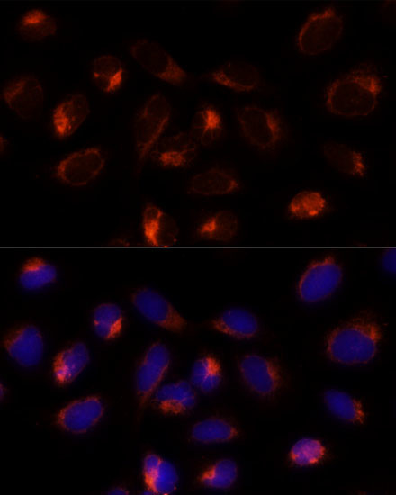 TXNDC12 Antibody in Immunocytochemistry (ICC/IF)