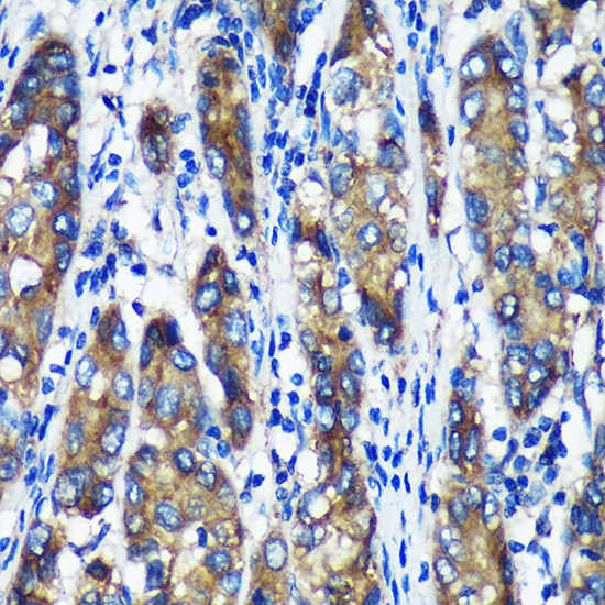 TXNDC12 Antibody in Immunohistochemistry (Paraffin) (IHC (P))