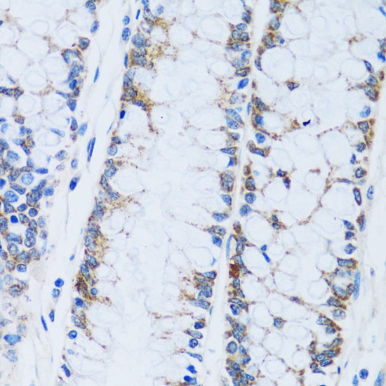 Carbonic Anhydrase XIII Antibody in Immunohistochemistry (Paraffin) (IHC (P))