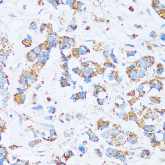 Carbonic Anhydrase XIII Antibody in Immunohistochemistry (Paraffin) (IHC (P))
