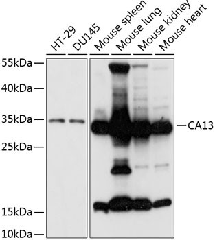 Carbonic Anhydrase XIII Antibody in Western Blot (WB)