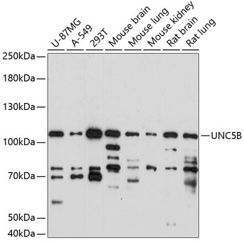 UNC5B Antibody in Western Blot (WB)