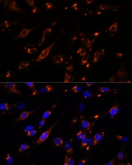 PTP4A2 Antibody in Immunocytochemistry (ICC/IF)